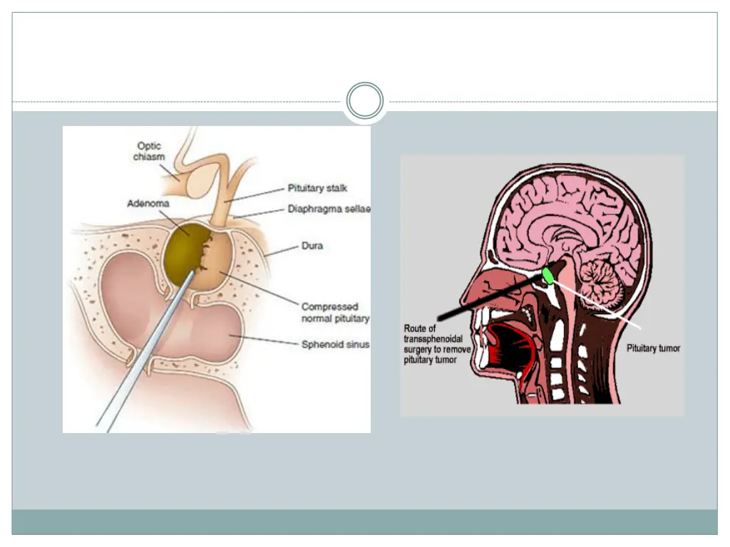 slide20
