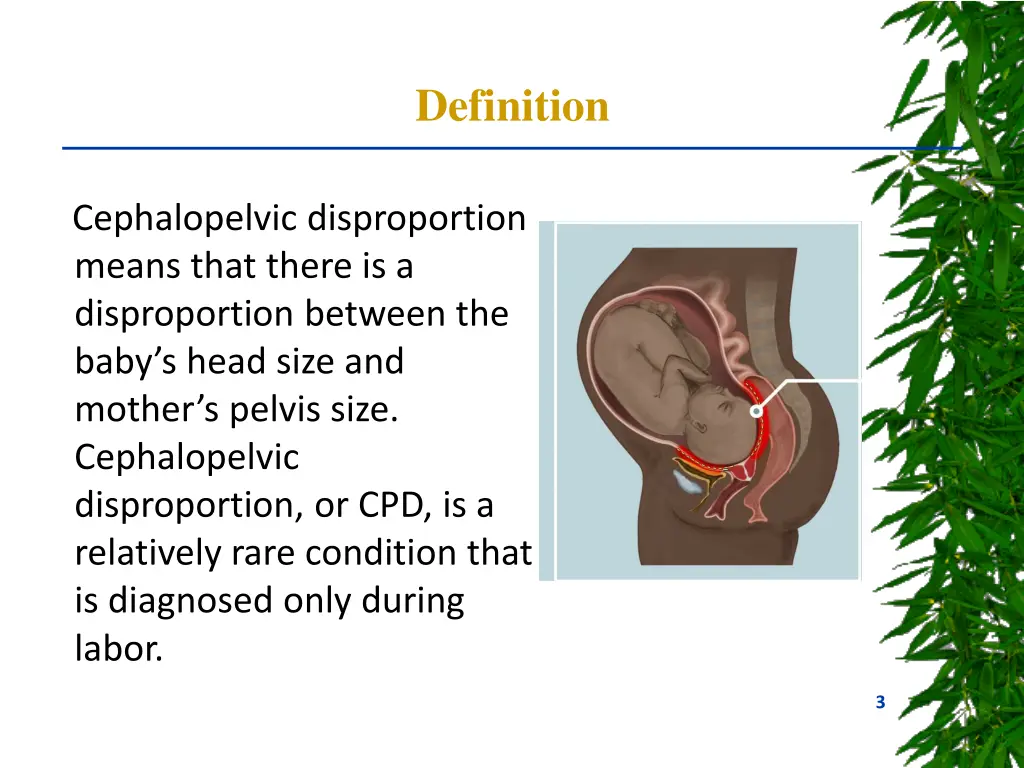 definition