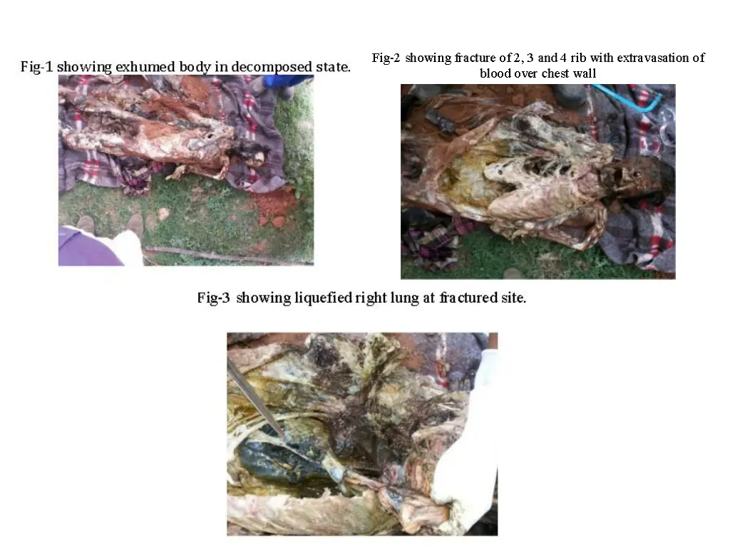 slide2