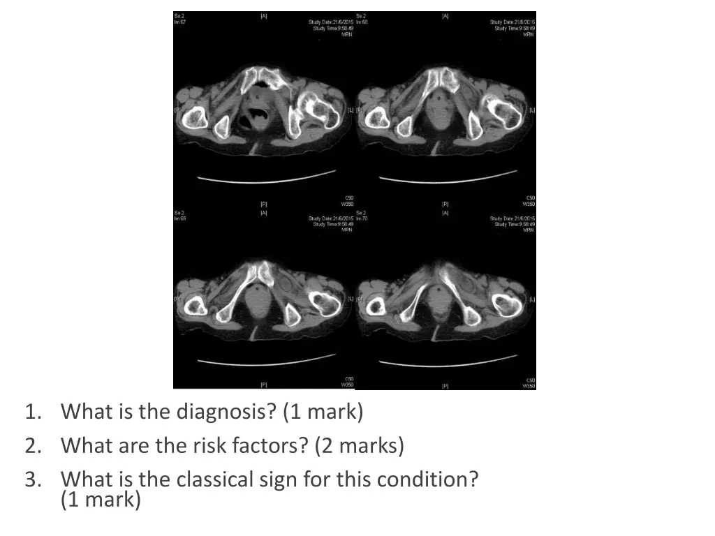 1 what is the diagnosis 1 mark 2 what