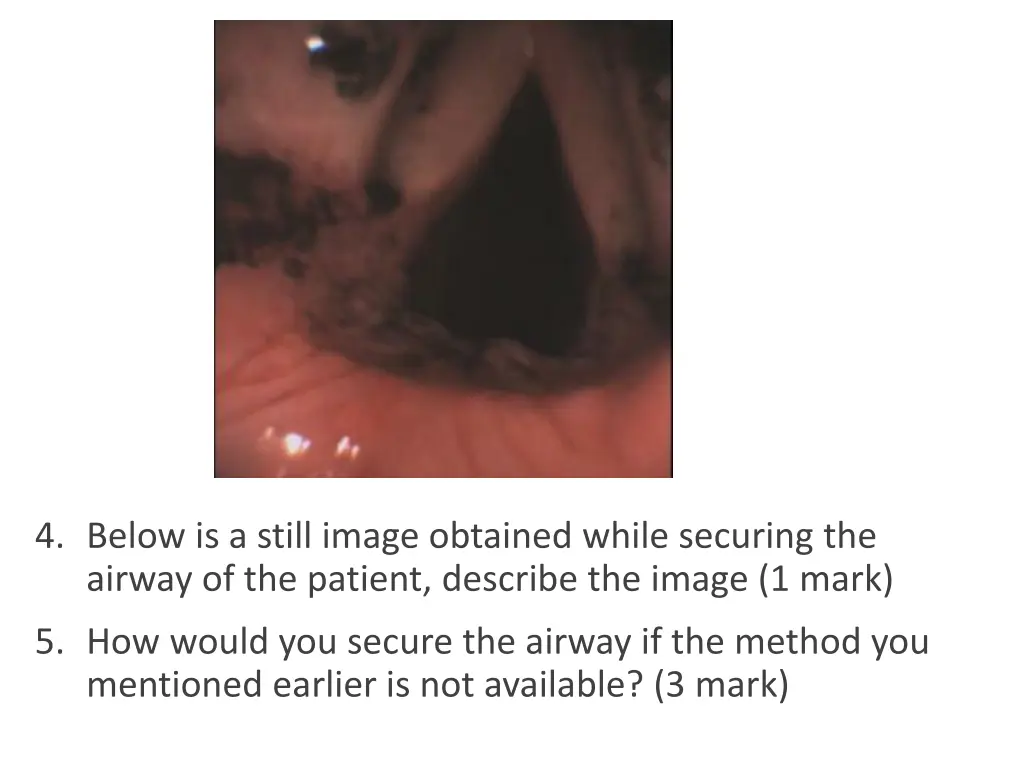 4 below is a still image obtained while securing