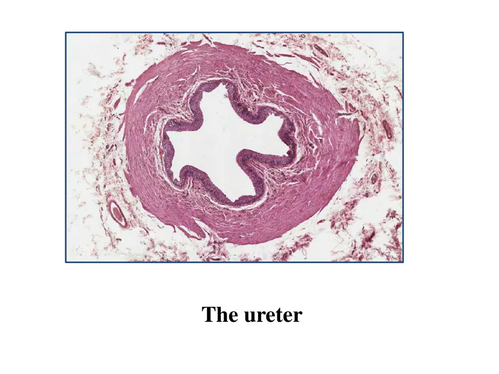 the ureter