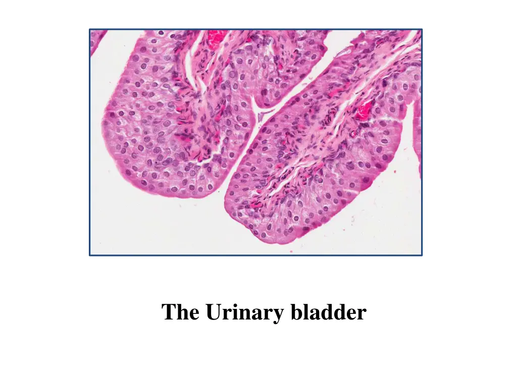 the urinary bladder 1