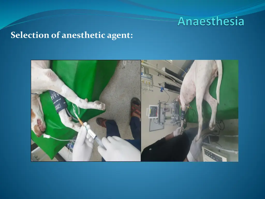 selection of anesthetic agent