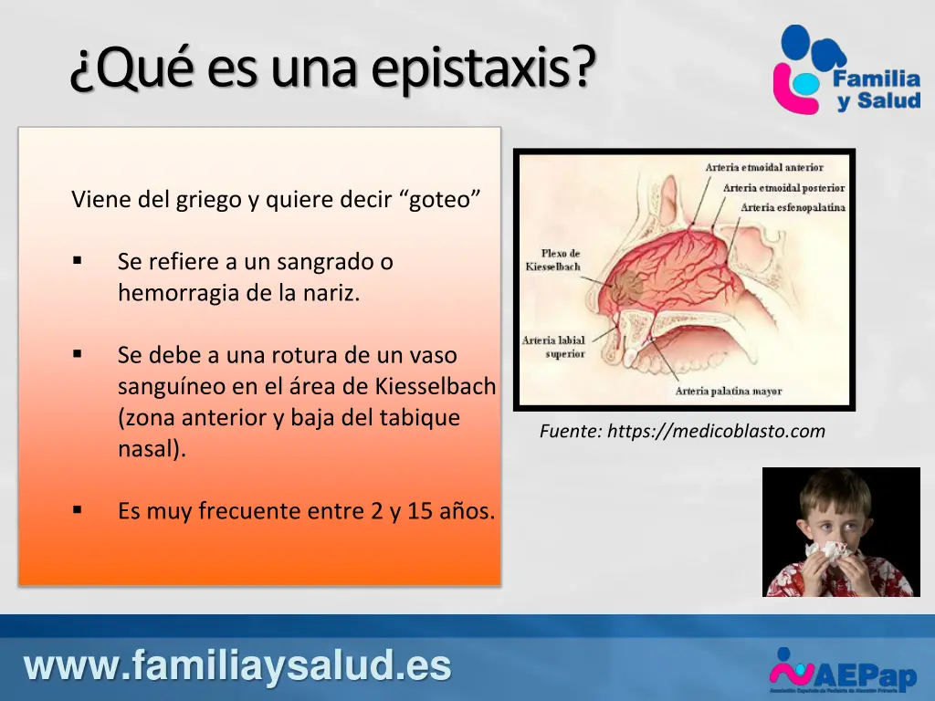 qu es una epistaxis