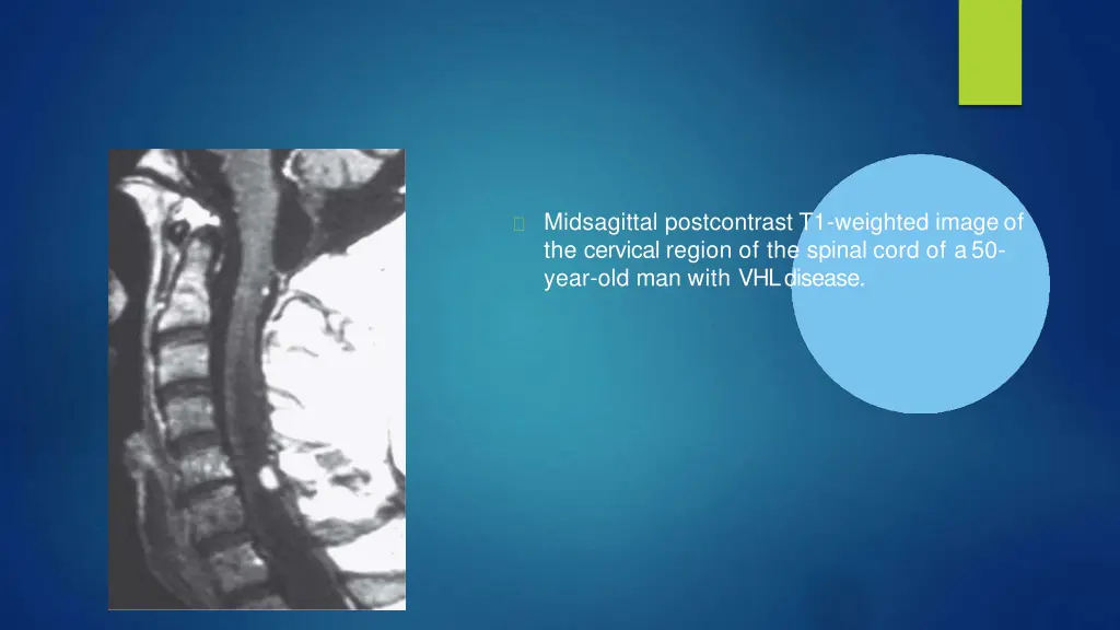 midsagittal postcontrast t1 weighted imageof