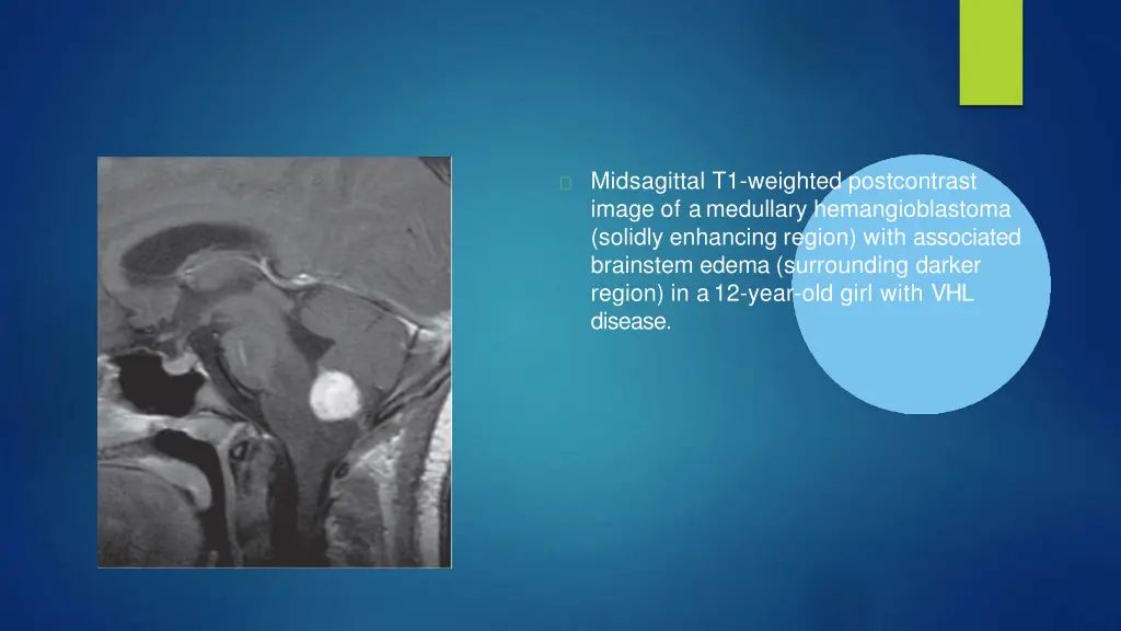 midsagittal t1 weighted postcontrast image