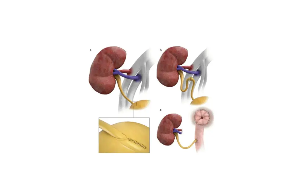 slide38