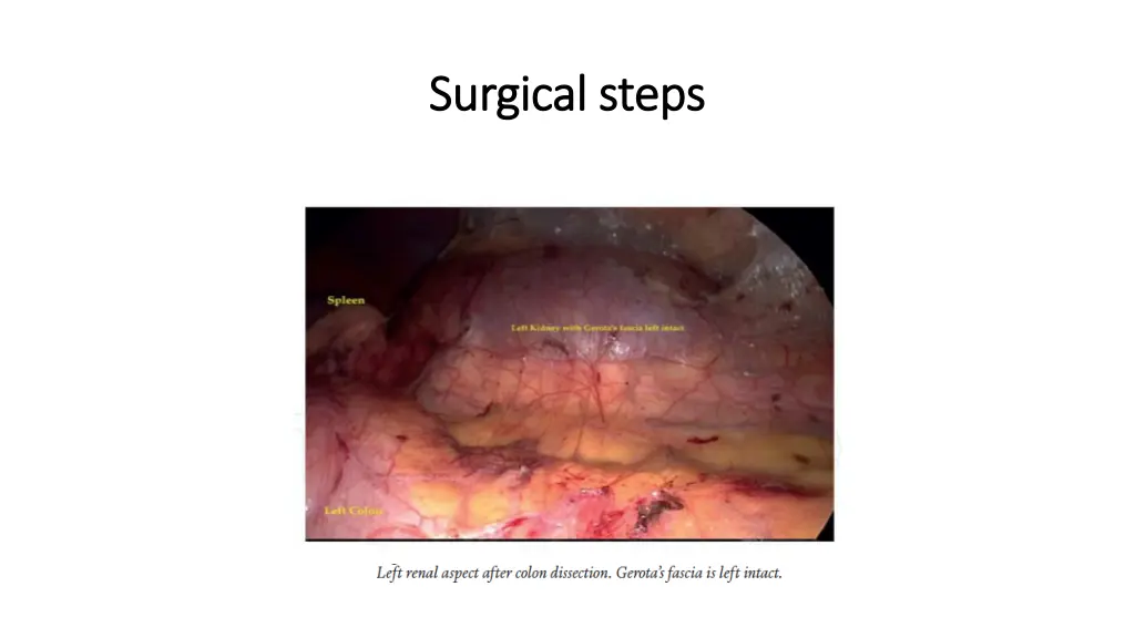 surgical steps surgical steps 1