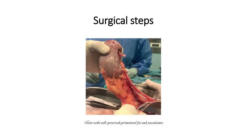 surgical steps surgical steps 4