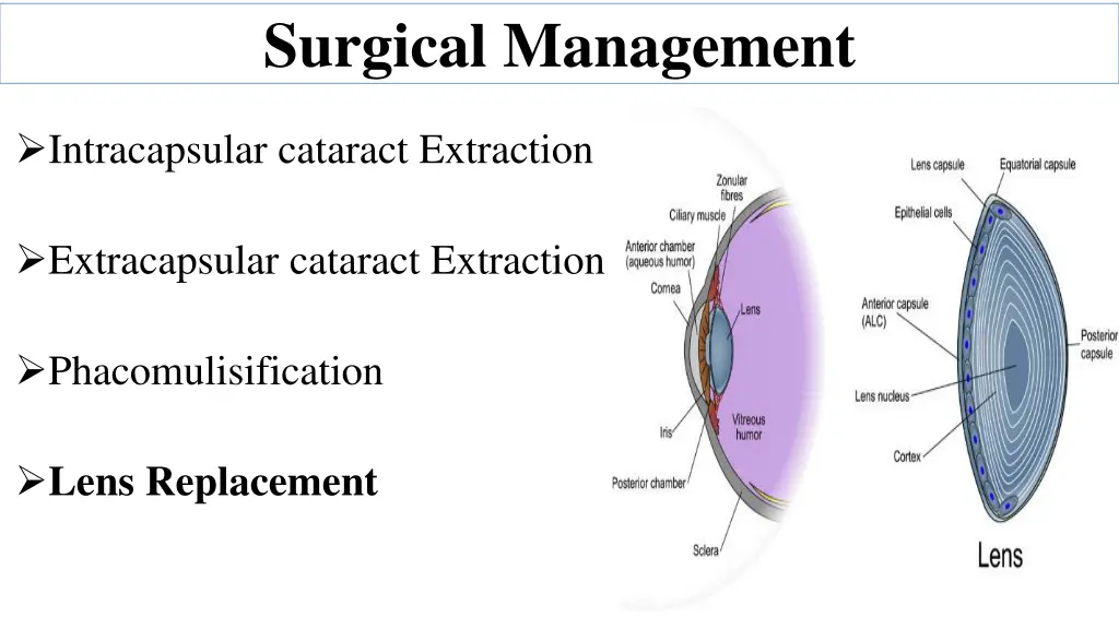 surgical management
