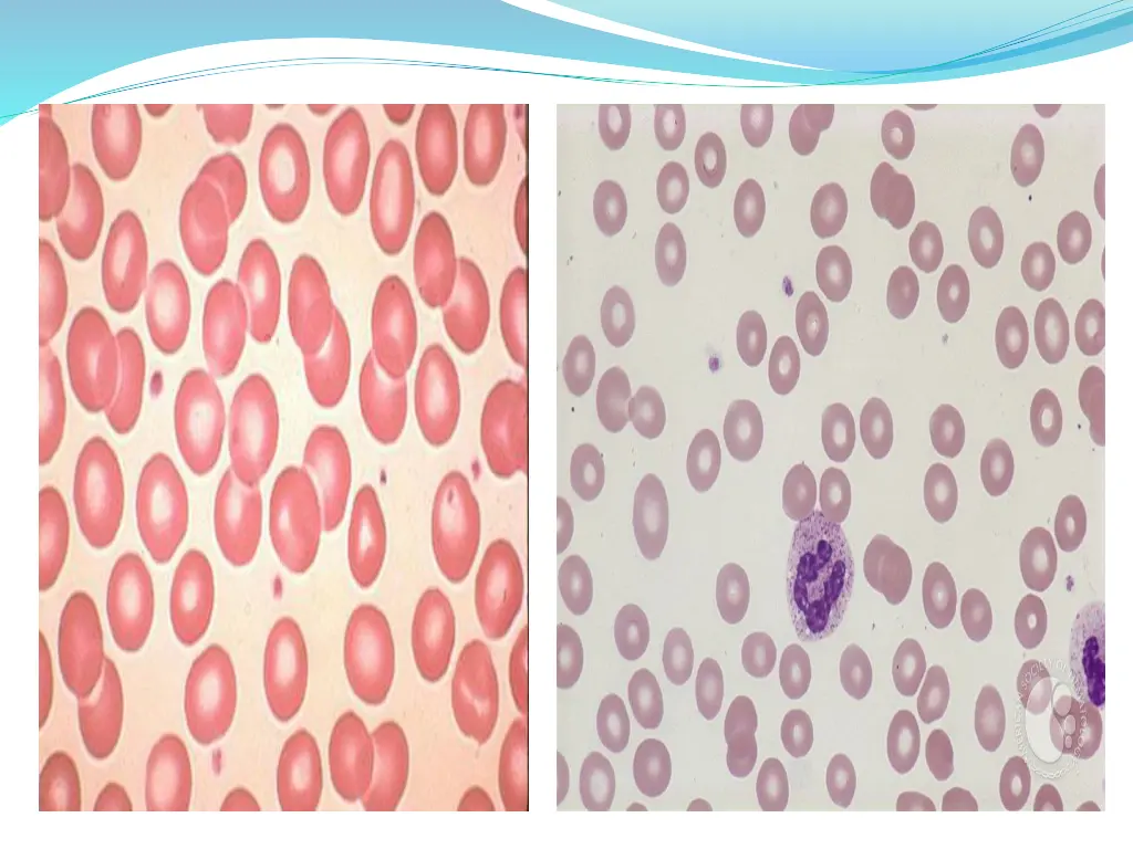 slide15
