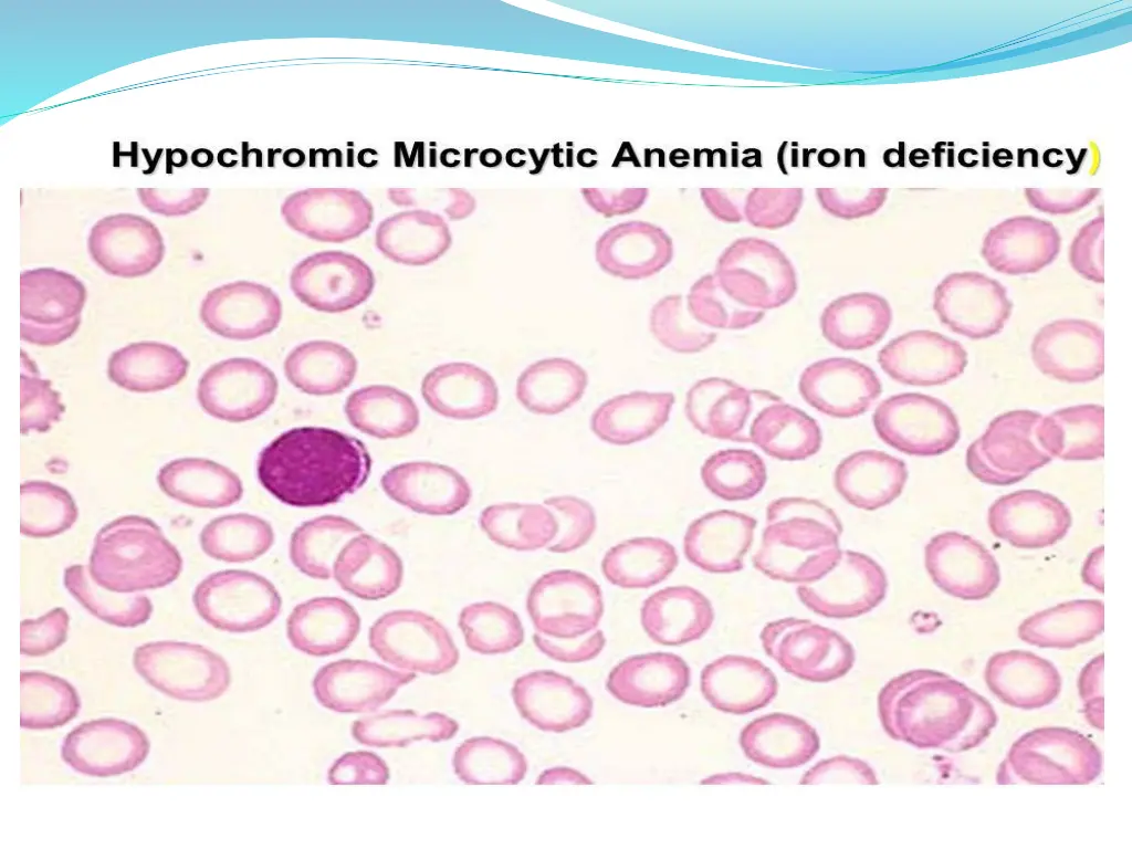 slide6
