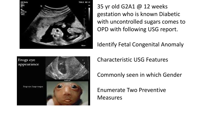 35 yr old g2a1 @ 12 weeks gestation who is known