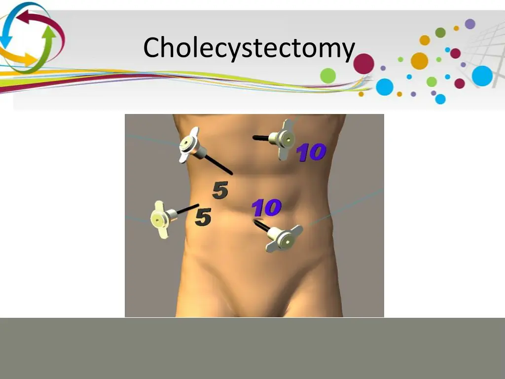 cholecystectomy 9