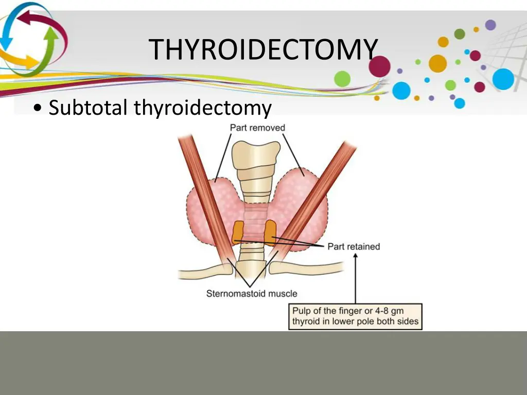 thyroidectomy 5