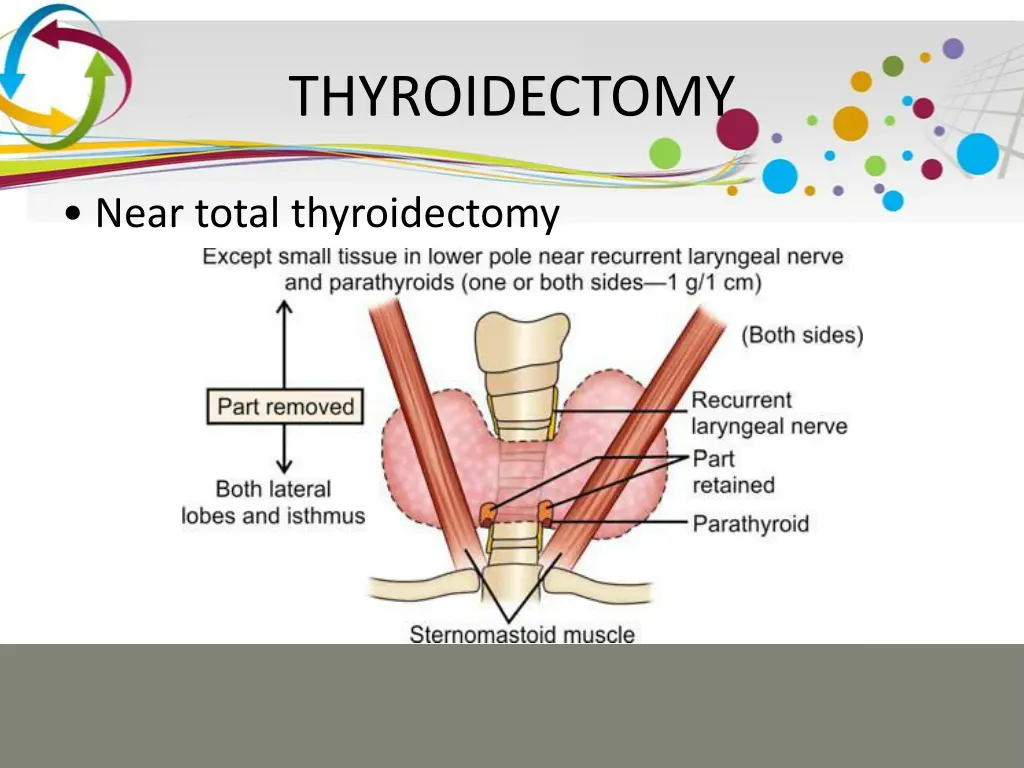 thyroidectomy 6