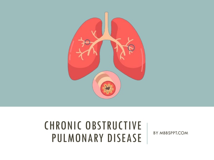 chronic obstructive pulmonary disease
