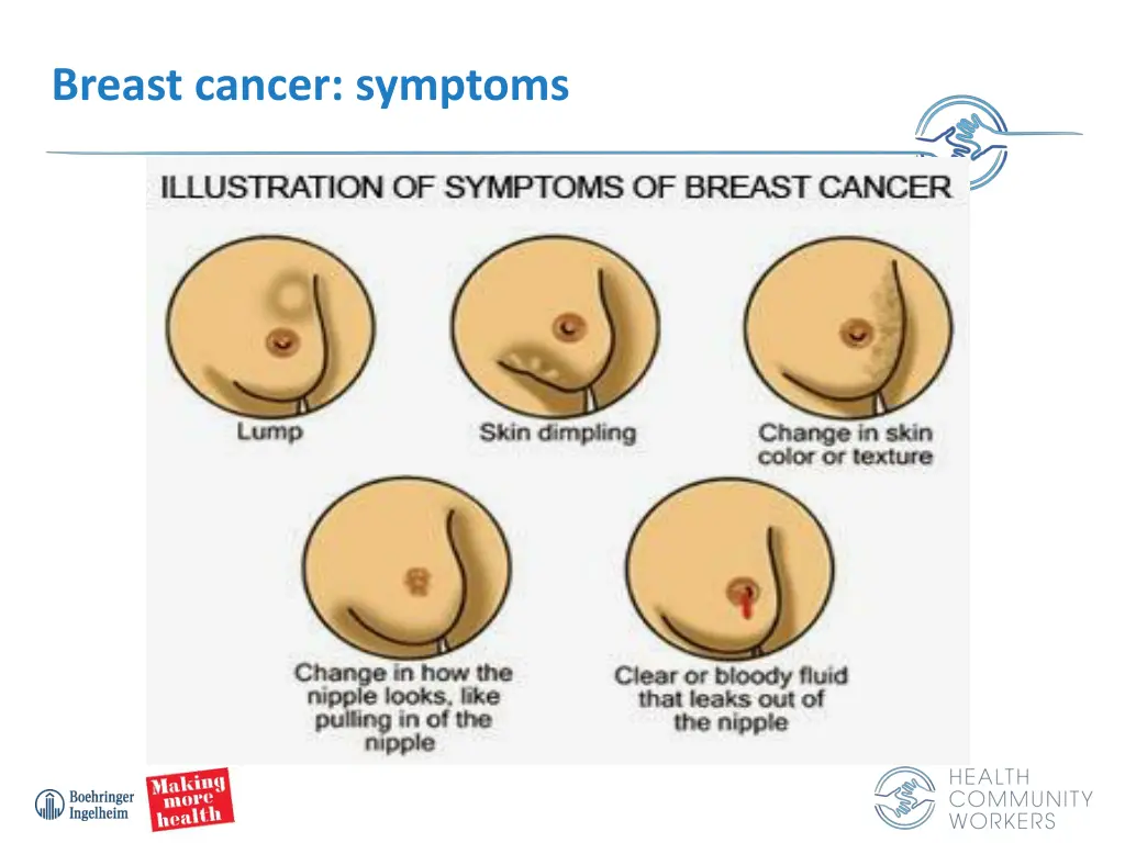 breast cancer symptoms