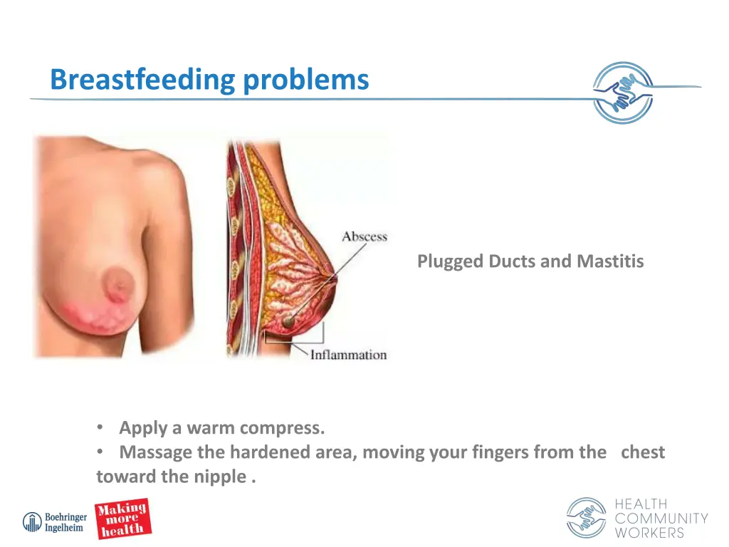 breastfeeding problems