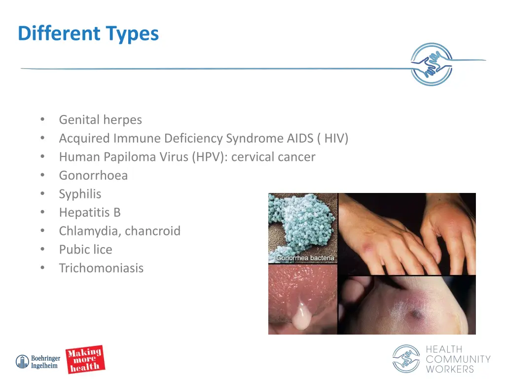 different types 1