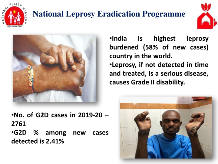 national leprosy eradication programme