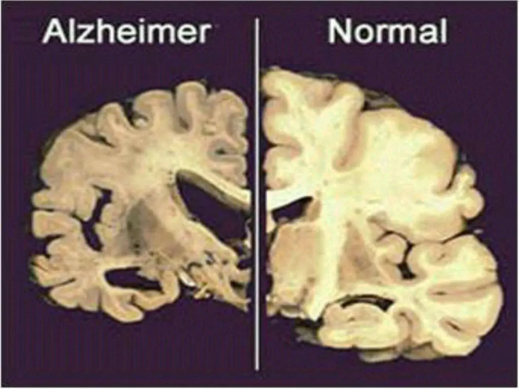 slide6