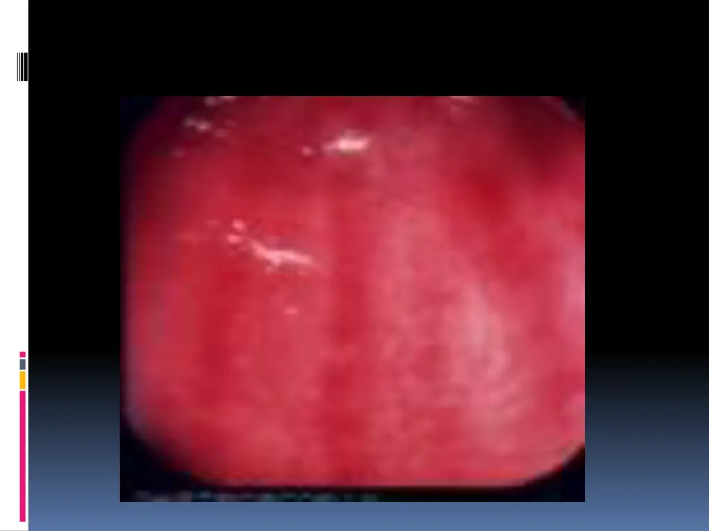 slide10