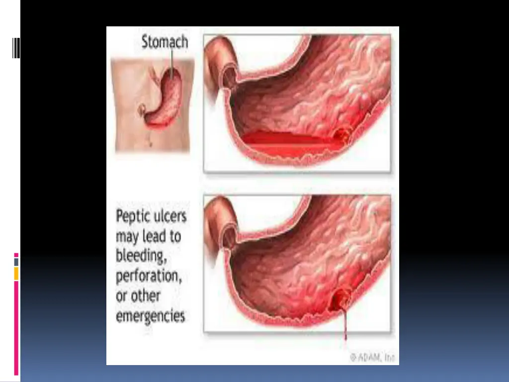 slide7