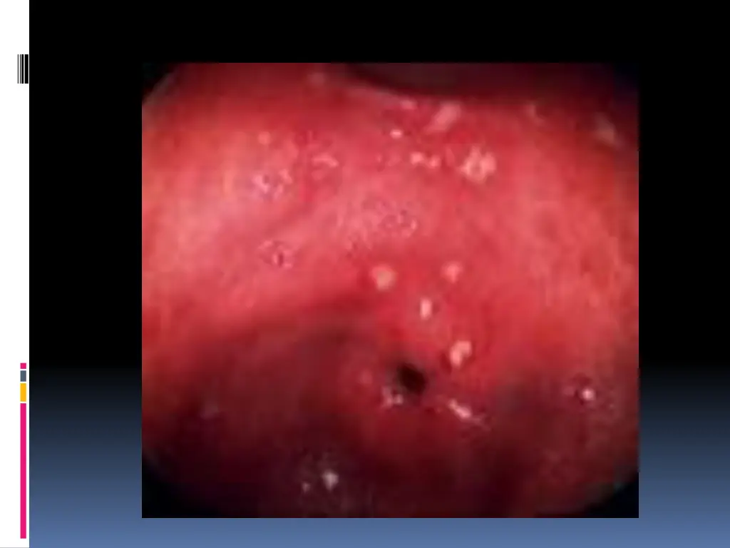 slide8
