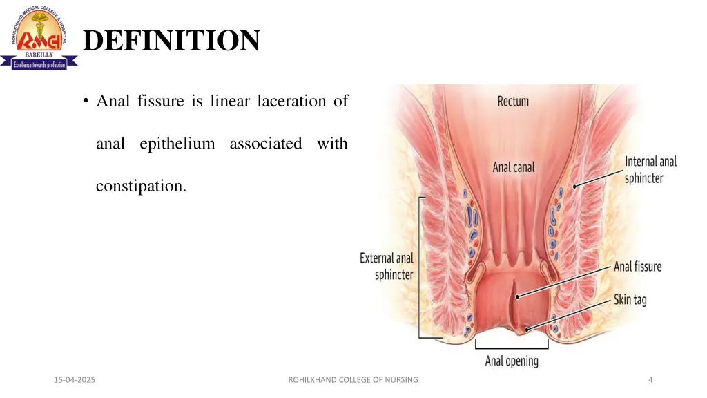 definition