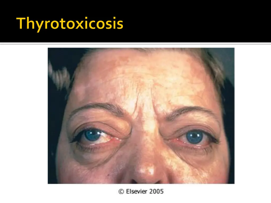 slide14