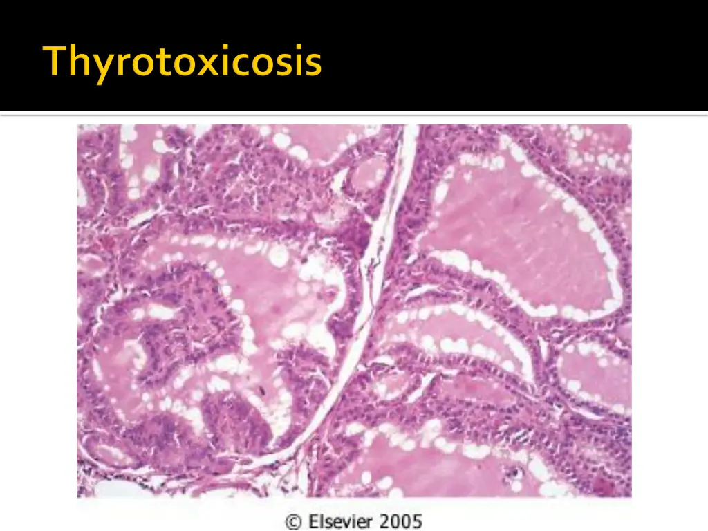 slide15