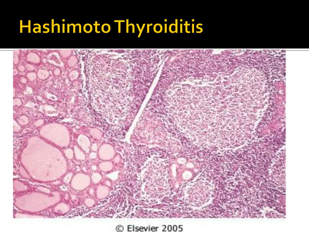 slide23