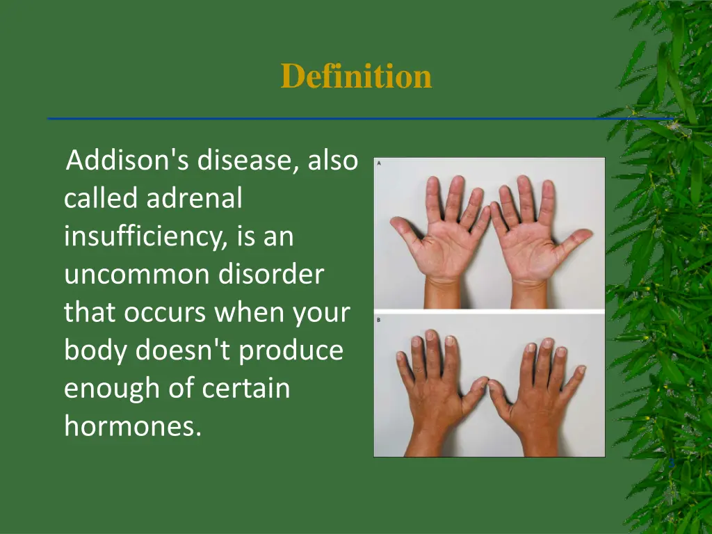 definition
