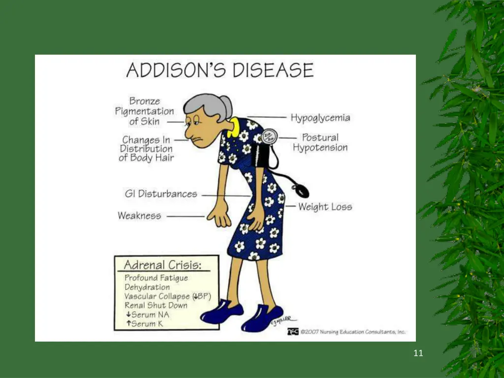 slide11