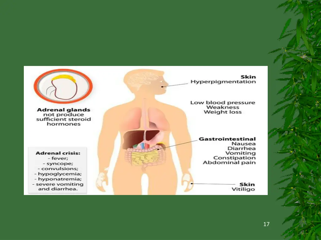 slide17