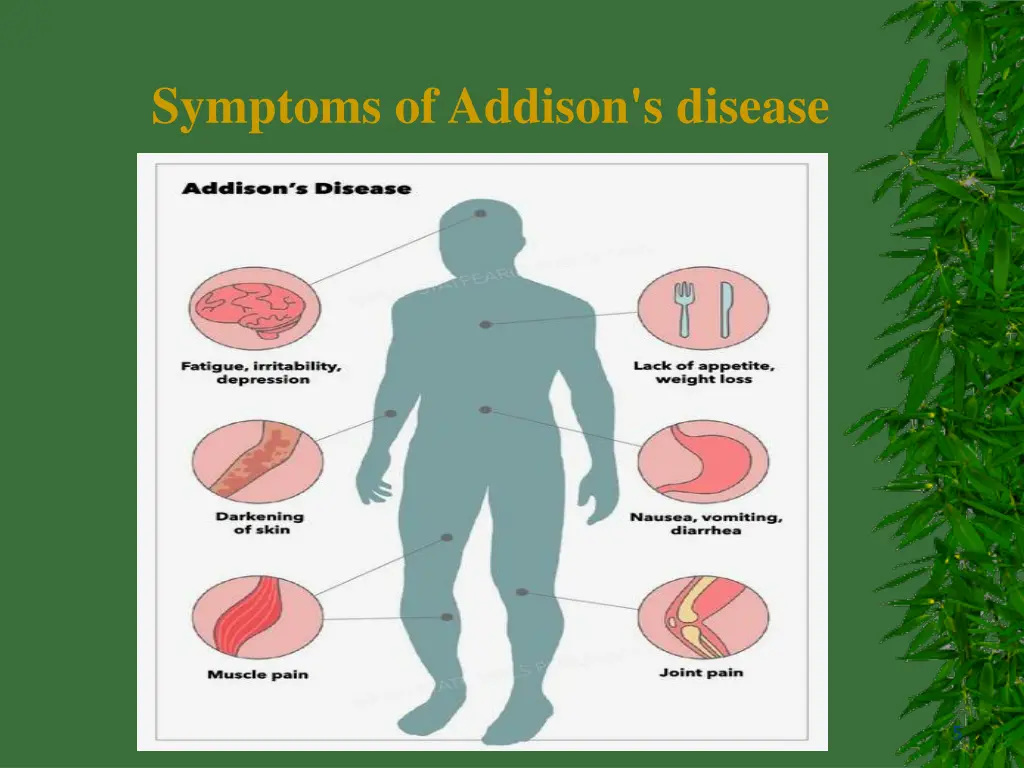 symptoms of addison s disease