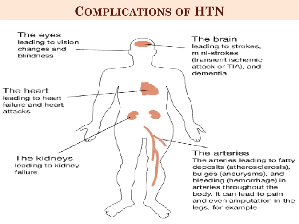 c omplications of htn