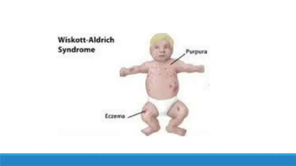 slide15