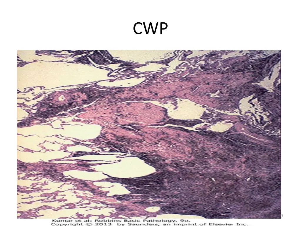 slide9