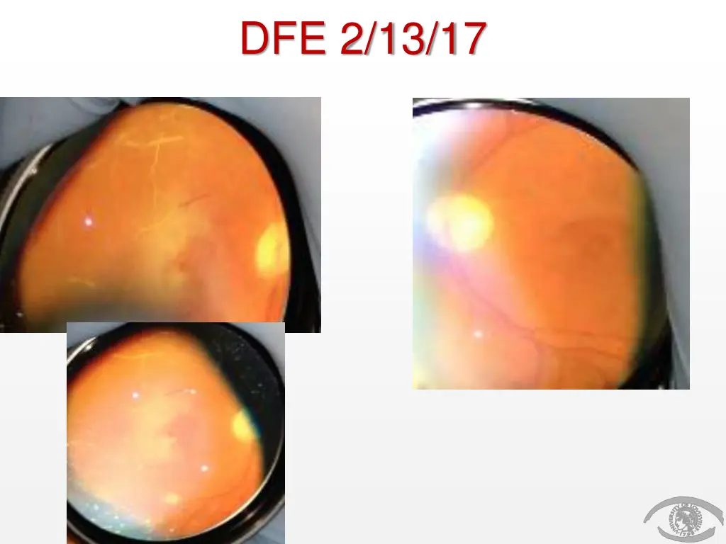 dfe 2 13 17
