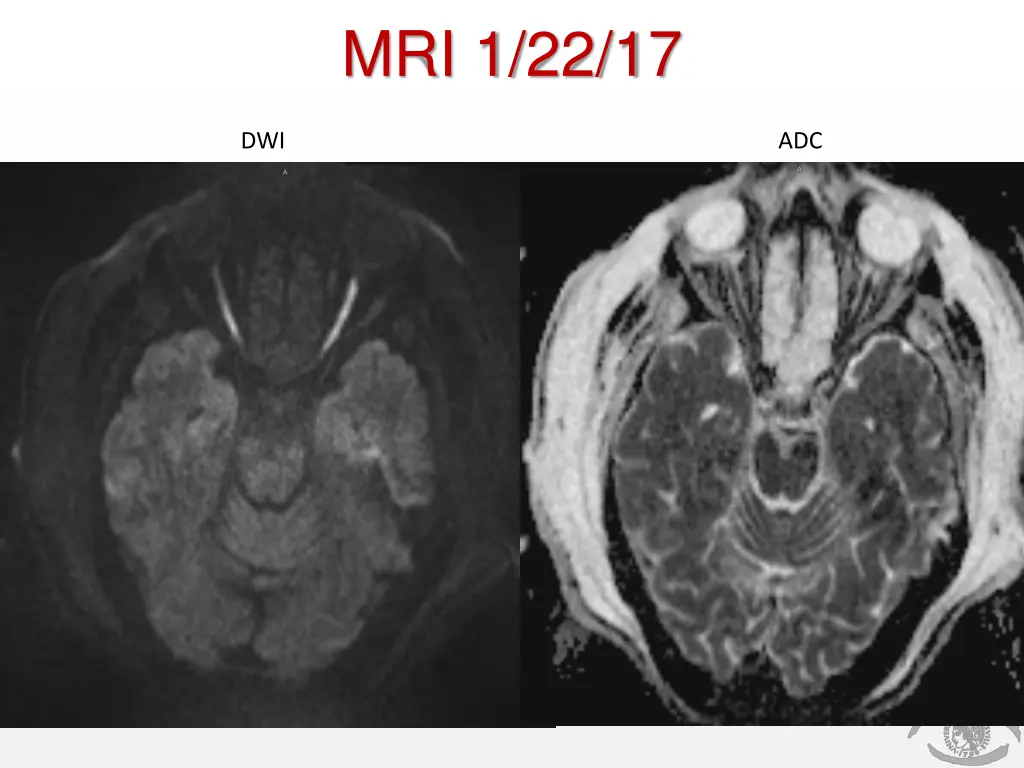 mri 1 22 17
