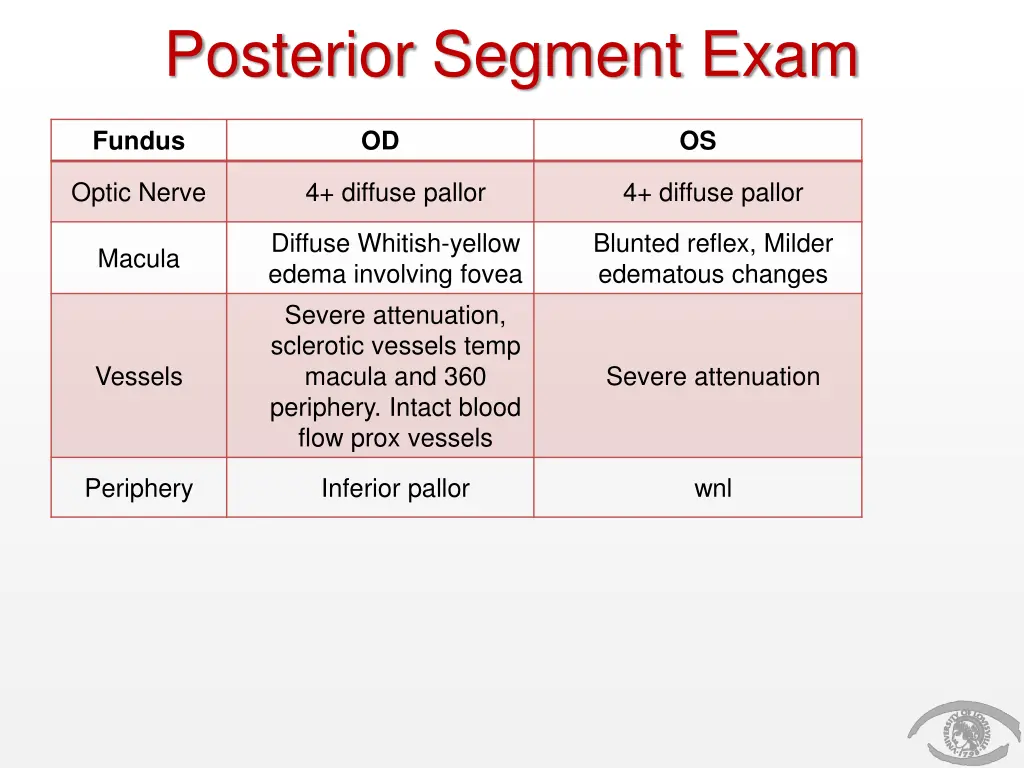 posterior segment exam