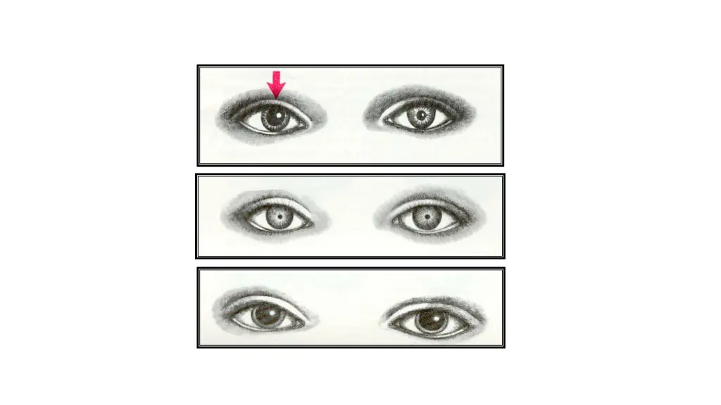 slide5
