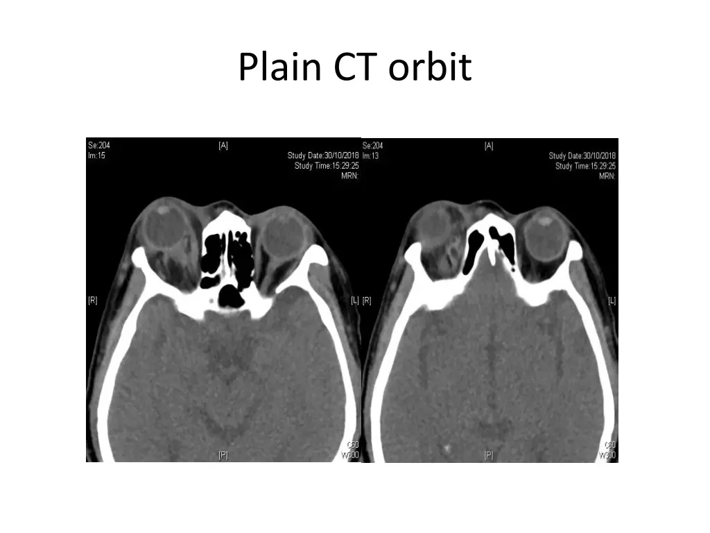 plain ct orbit