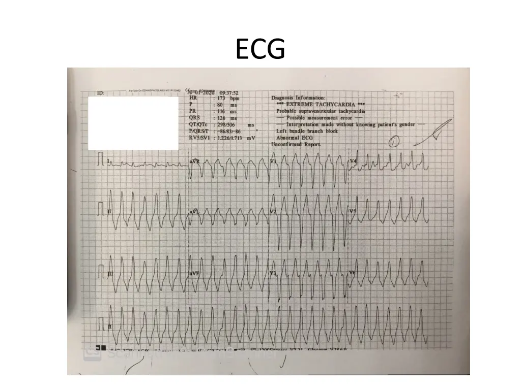 slide3