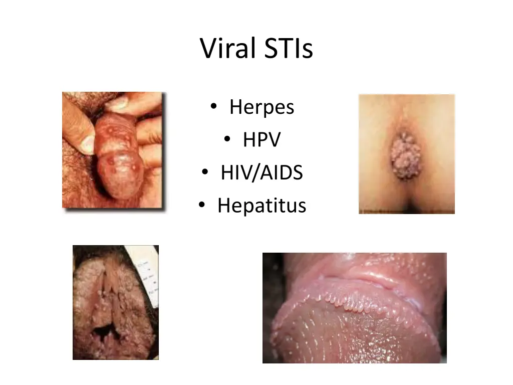 viral stis