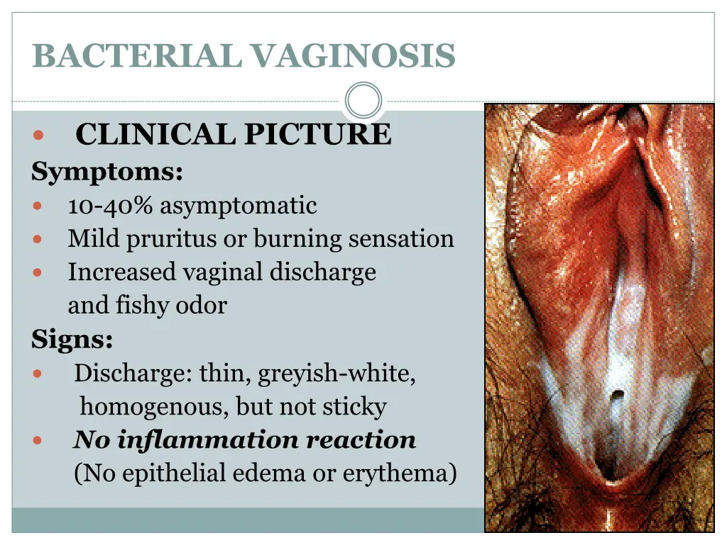 bacterial vaginosis 2