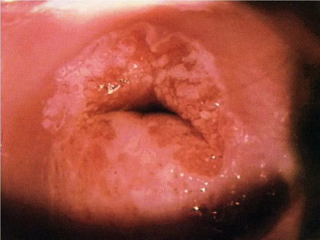 slide47